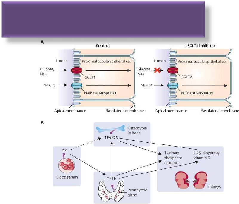 SGLT-2 İnhibitörleri ve Kemik Güncel verilerde; SGLT-2İ, kalsiyum ve fosfor metabolizmasında değişme ve fosfor düzeylerinde artış, Bu artışa bağlı PTH ve FGF 23 düzeylerinde yükselme, 1,25 dihidroksi