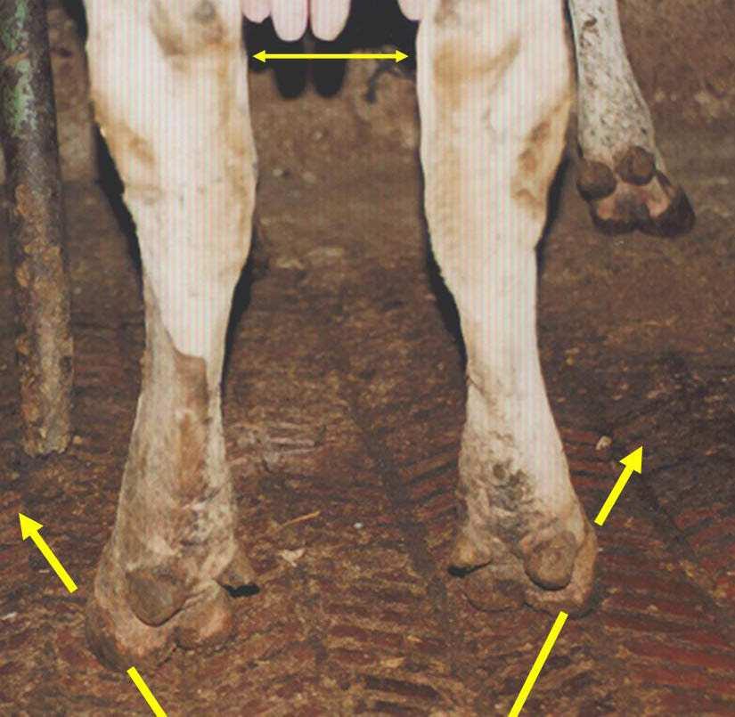 Dizler birbirine yakın ve ayakları uzak olan, yani X bacaklılığın