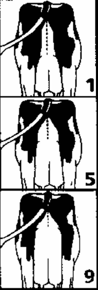 görünüşüne bakılır (13) ve meme tabanının arka meme başları arasında bulunan hattın altında veya