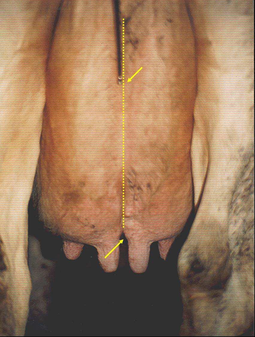Meme tabanı hattın 1 cm altında kalıyor ise ineklere 1, aynı seviyede ise 3, 1 cm üstünde kalıyorsa 4,