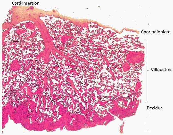 Histology of Human Plasenta,