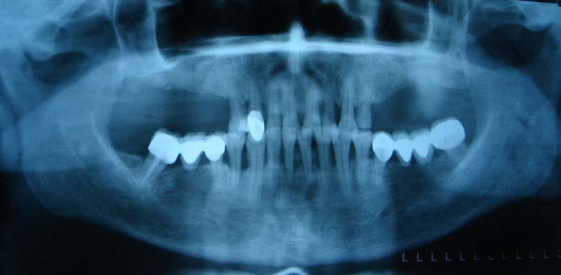 panoramik radyografisi Resim 7.