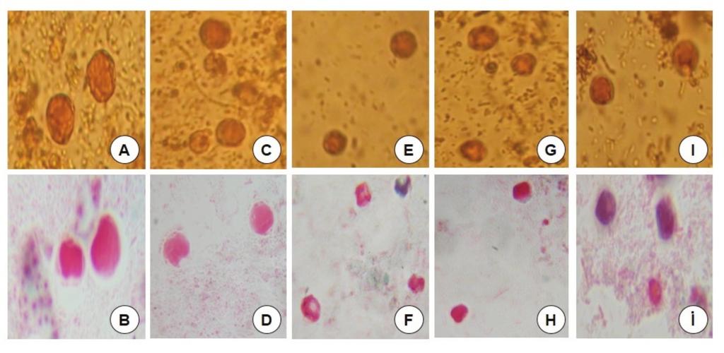 Türk Mikrobiyol Cem Derg 2018;48(4):247255 Şekil 1. (A ve B) Direkt lugol inceleme ve trikrom boyamada Blastocystis spp.