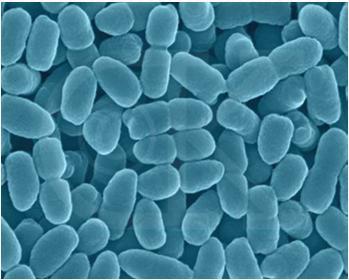 Bordetella pertussis Bordetella cinsi tekli veya çift olabilen, minik Gram