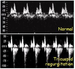 regürjitasyonu değerlendirilmesinde güvenilir değildir Pulse