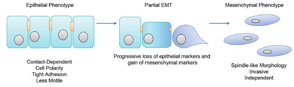 Epithelial- Mesenchymal Transition