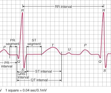 Kalbin elektriksel iletim sistemi Ventriküllerin uyarılması purkinje fiberleri ile olur. Bunlarda aksiyon potansiyelinin hızı 2-4 m/s kadardır.