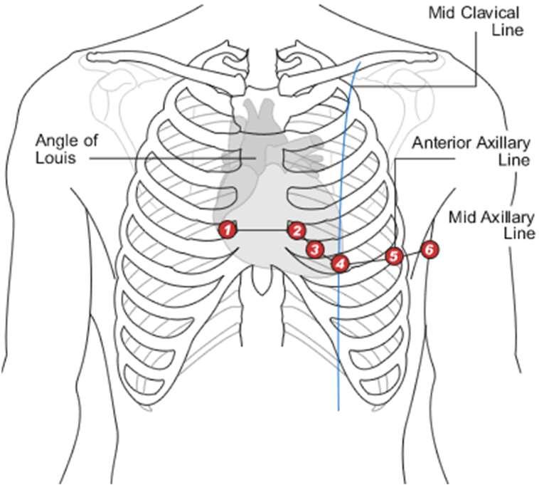 EKG Derivasyonları E) Göğüs derivasyonları Kardiyak vektörünün transverse düzlemdeki izdüşümü de kalbin durumu hakkında önemli bilgiler vermektedir.