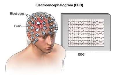 Elektroensefalogram (EEG) Beynin sinirsel faaliyetleri sonucu oluşan biyoelektrik işaretlere Elektroensefalogram (EEG) adı verilir. EEG nin çok karmaşık bir yapısı vardır ve yorumlanması zordur.