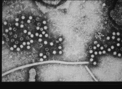 Hepatit E Virüsü İk 1978 de Kaşmir de non-a, nonb hepatit