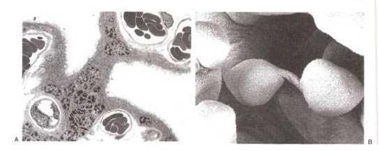 bağlayan sinsityal köprünün TEM görüntüsü, x1500; B: Sinsityal köprünün SEM görüntüsü x890, (Pathology of the Human Placenta, 2006) Sitotrofoblastların, insan koriyonik gonadotropini