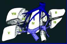 Karaciğer anatomisinin daha iyi anlaşılması (Quinaud) Greft/Alıcı volüm uyum