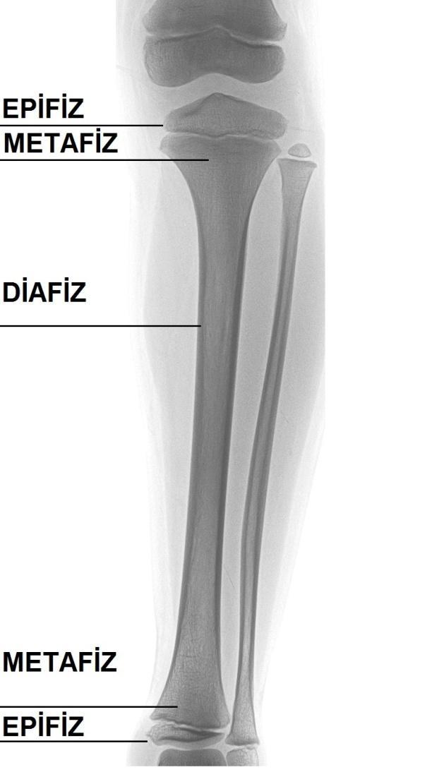 çıkan tendonların yapışma yeri olan apofizler, büyüme ile ilgili olmayan kemikleşme merkezleridir(9). Şekil 1.