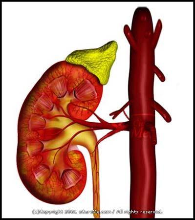 PİYELONEFRİT Böbrek yapılarının Inflamasyonudur: renal