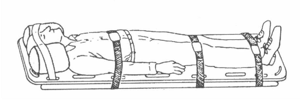 Servikal vertebra travması varsa boyun iki yanına ince yastık veya kum torbaları ile desteklenir veya servikal boyunluk varsa bu dikkatlice takılır.