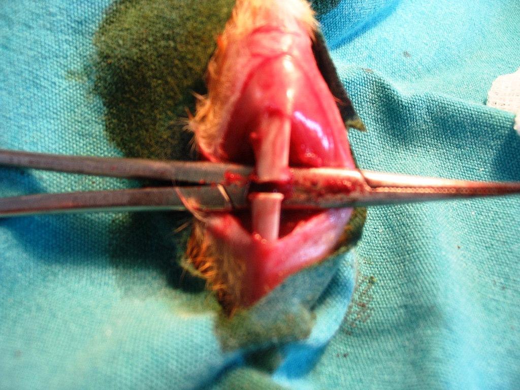 Şekil : Cerrahi işlem esnasında osteotomize edilmiş tibianın görünümü Opere Edilen Tibia Sayısı Üçüncü