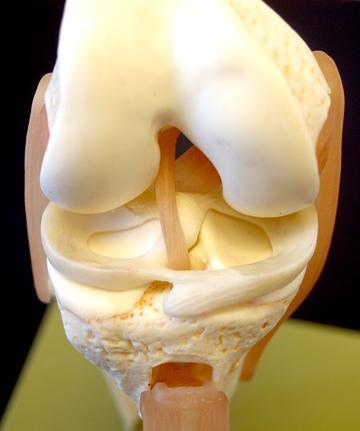 4 Şekil 2. Distal femur ucu Lateral kondil hem anterior-posterior (AP) hem de lateral planda medialden daha küçük yapıdadır. Bu şekil dizin doğal valgus yapısına katkıda bulunur.