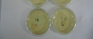 Herbir örnek yüzeyine 100 µl bakteri süspansiyonu eklendi ve 15 dakika beklenerek bakterilerin pelikül