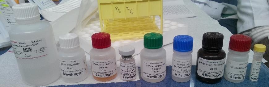 Sinoviyal Sıvılarda IL-1β, IL-6, IL-8 ve TNF-α Konsantrasyonlarının Belirlenmesi Alınan TME sinoviyal sıvı örneklerinin toplanması sonrasında IL-1β, IL-6, IL- 8 ve TNF-α analizleri Selçuk