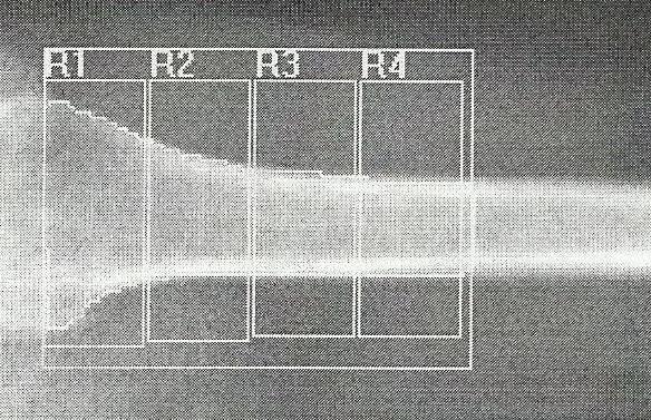 Şekil 6. Humerus proksimali transvers ekseni için ilgi alanları 3.