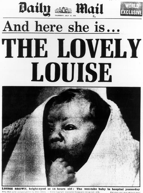 İlk IVF Bebeği 26/07/1978 Louise Brown Doğal siklus İdrarda LH monitorizasyonu 26