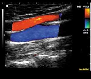 Operasyon Öncesi Damar Haritalaması Arteryel ve venöz sistemin anatomisi ve akım özellikleri