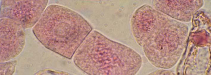 gösteren hücreler (X400)