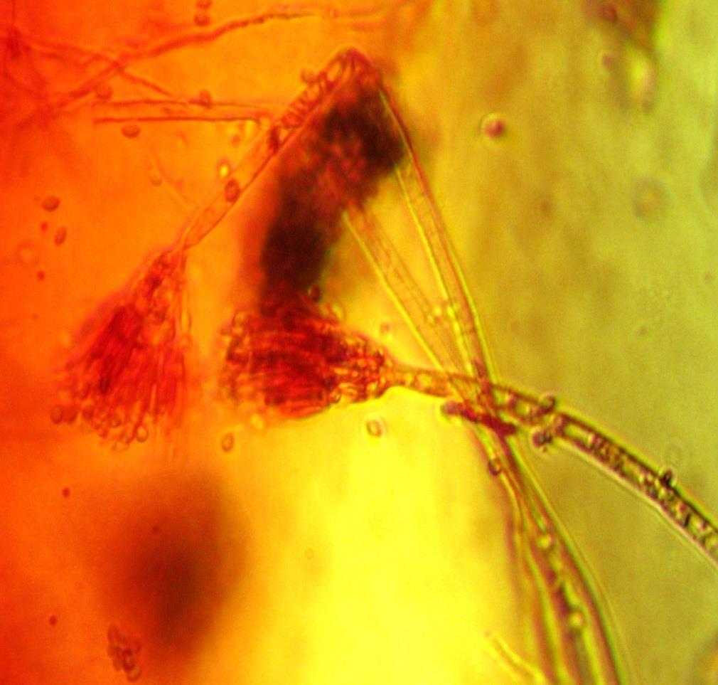 Lam kültürü mikroskobik incelemede; Septalı, hyalen hifler, konidiyoforlar ve konidyaforlardan dallanan birkaç
