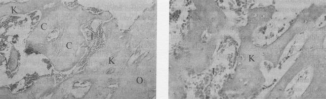 4. haftada kontrol grubuna ait bir örnek. Yoðun fibröz doku oluþumu (F) ve az miktarda kemik lamelleri (K) görülmektedir (HEx200). Resim 5.