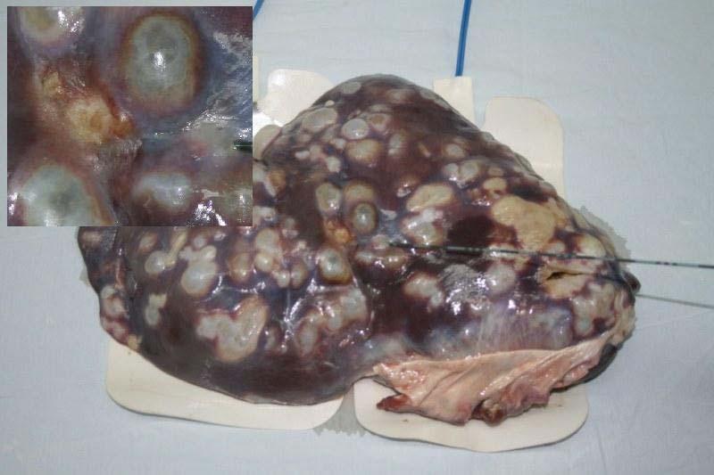 Şekil 9: RFTA işlemi yapıldıktan sonra kist hidatikli koyun karaciğerinin görünümü(sol üst köşe; ablasyon