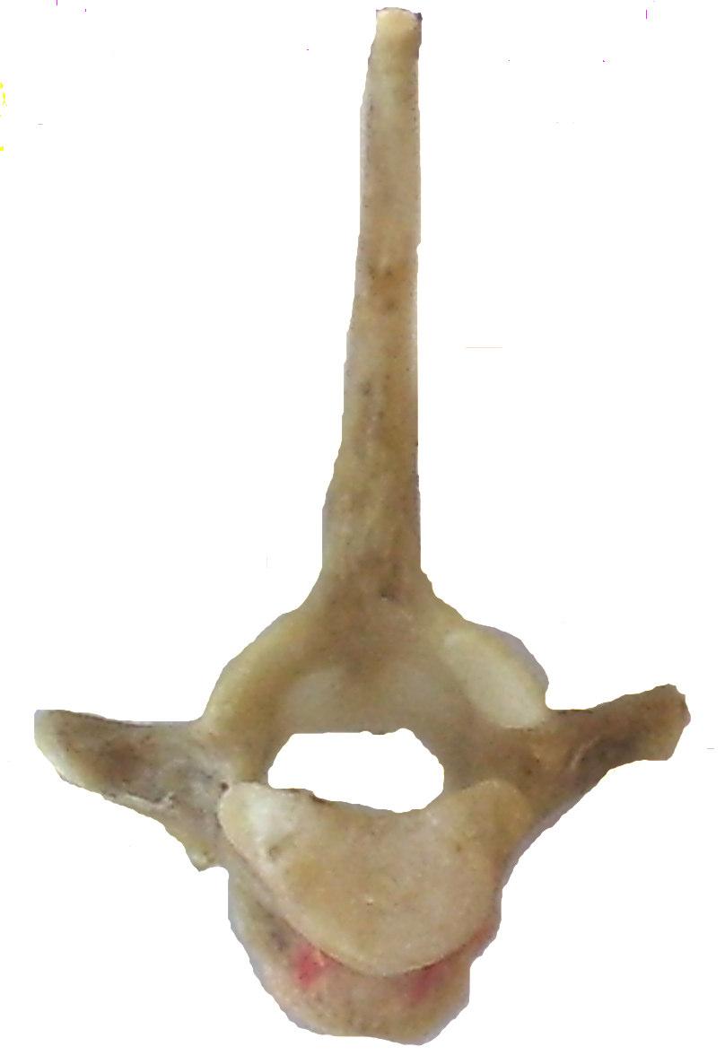 17 2.4.2. Vertebrae Thoracicales processus spinosus processus transversus fovea costalis foramen vertebrale corpus vertebrae Şekil 2.5: Tavşan göğüs omurunun alttan görünüşü.