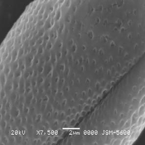 87 µm ve polen şekli suboblat. Amb çapı 21.3 µm ve şekli semiangular. Ekzin subtektat, ornamentasyon kutupta ve ekvatoral bölgelerde mikroretikulat. Ekzin, ekvatorda ve kutuplarda 1.22 µm kalınlıkta.