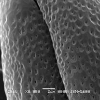 4 µm Polar Eksen(P) 22.5 µm (15.6 µm -24.