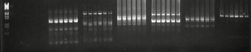 kullanılarak 6 nohut genotipinde yapılan ISSR analiz sonuçları. A B C D E F G Şekil 4.3.