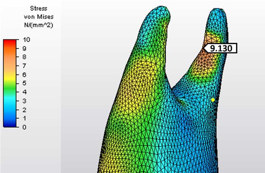 67 4.2. Dentin Dokusunda Oluşan Stres Bulguları 4.2.1. Dentin Dokusunda Oluşan von Mises Stres Bulguları Kontrol grubunda dentin dokusunda biriken stres miktarı 9.937 MPa olarak bulunmuştur.