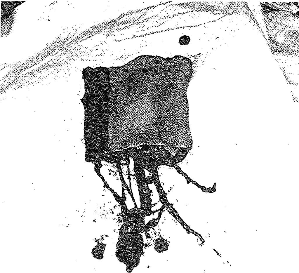 sefana magnaya uç uca anastomoze edildi (Şekil 9, 10). OLGU 3 V.Ö., 33 yaşında, erkek. intihar girişiminde bulunarak penisini ampüte eden hastaya, ön koldan 11x13 cm.