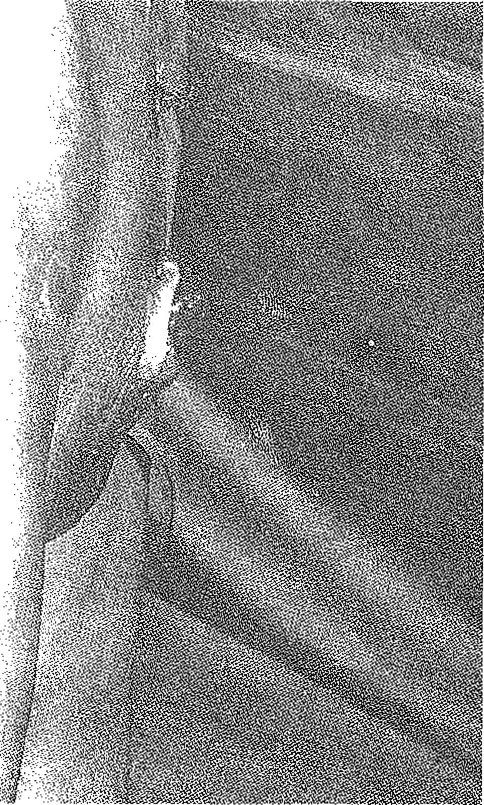 Üret- ŞEKİL 9 : İkinci olgunun operasyon öncesi görünümü ra yine sol supraklavikular kılsızbölgeden tamkalmlıkta deri grefti ile oluşturuldu.
