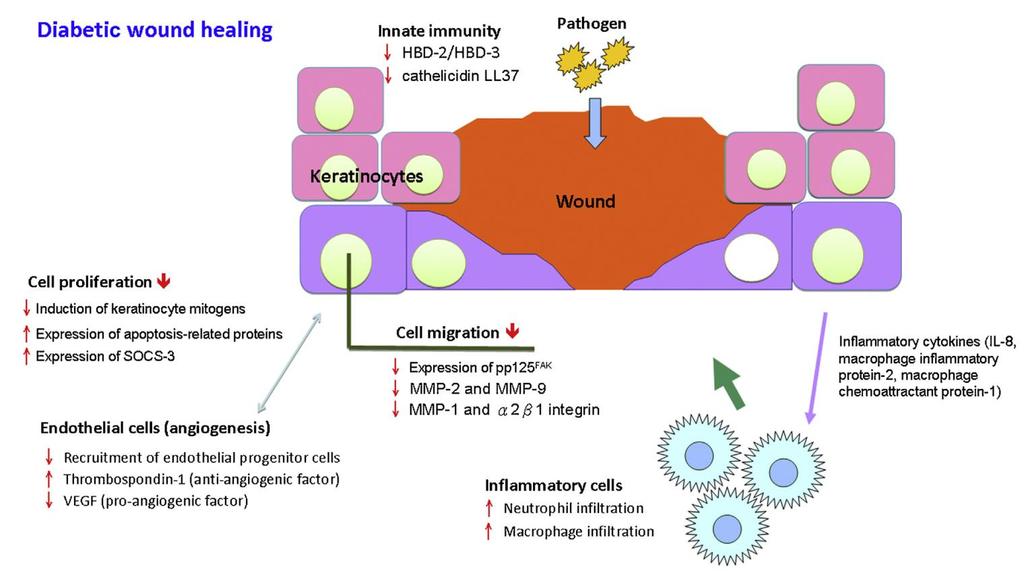 Stephen Chu-Sung Hu, High-glucose environment disturbs the