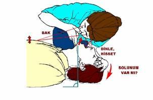 B. Solunumun Değerlendirilmesi: İlk yardımcı, başını -hasta/yaralının -göğsüne bakacak şekilde yan çevirerek yüzünü hasta/yaralının ağzına yaklaştırır, Bak-Dinle-Hisset