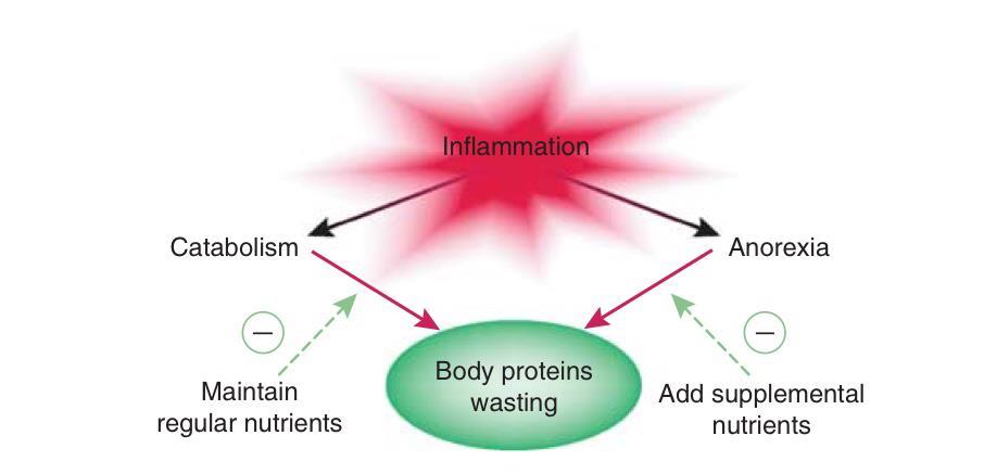 İnflamasyonun etkisi PEW sendromunun tedavisinde katabolizma artışı