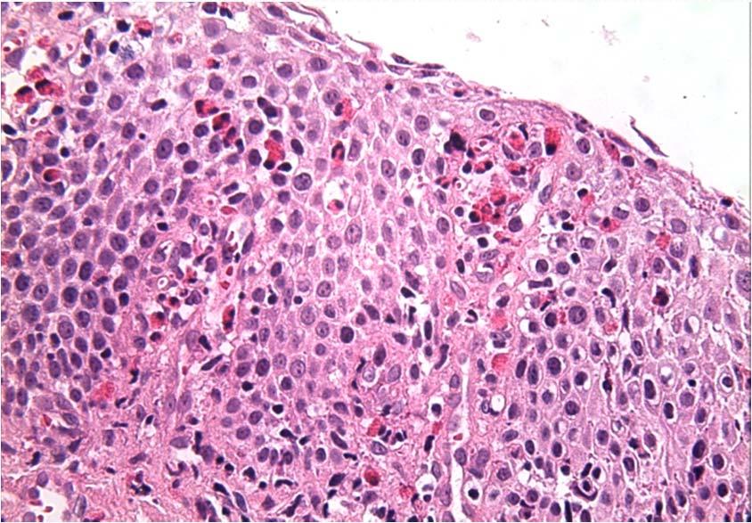 therapy. Pediatr Dev Pathol 1999. 2 (1):15 18.) 6. Chadwick, L. M., J. J. Kurinczuk, L. A.