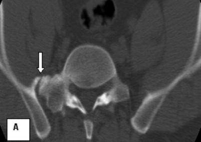 Radiology Oyar et al. Seçer ve ark.