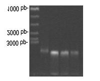 BULGULAR 4.1 DNA izolasyonu Organik DNA izalasyon yöntemi kullanilarak PZR da kullanabilecek kalitede DNA örnekleri basariyla elde edilmistir.