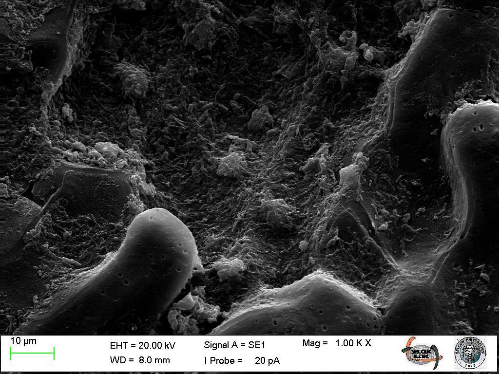 (chancing SEM Photos with pure water