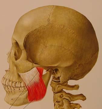 M.Masseter Derin Demet M.Masseter Yüzeyel Demet Resim 3: M.Masseter (K. Nakazawa) MUSCULUS TEMPORALİS: Fossa temporalis ve kafatasını Lateral yüzeyinden başlayan yelpaze şekilli bir kastır.