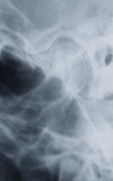 ağzın kapalı konumdaki röntgenleri