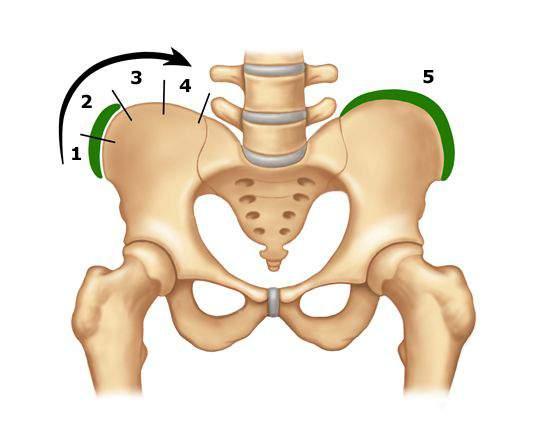 Risser Bulgusu Ø PA spinal radyogramlarda iskelet maturasyonunu