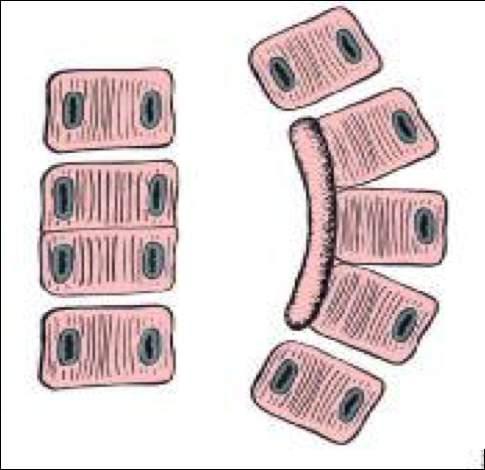 Komplet ( Hemivertebra ) 2.