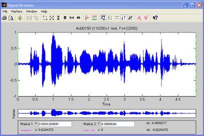 179 EK-2 (Devam)Ses Dosyaların Görüntüsü (Au00150)Stego Sese Ait Audio Unitin İşaret Örün Tarayıcısı (%50 veri