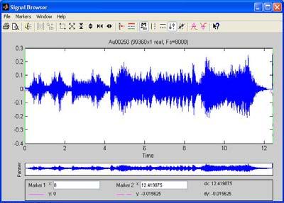 Tarayıcısı(%0 veri gizlenmiş) (Au00110)Stego Sese Ait Audio Unitin İşaret Örün Tarayıcısı (%10 veri gizlenmiş)
